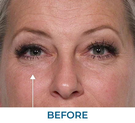 Before - Tiffany G., FL