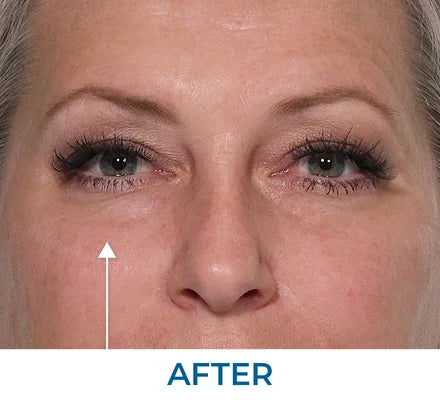 After - Tiffany G., FL