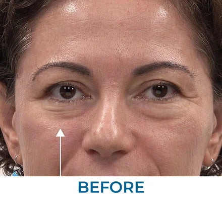 Before - Rita B., NY