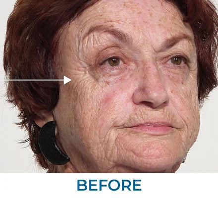 Before - SEFOREMaria Z., FL