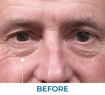 Before - Ron D., NY