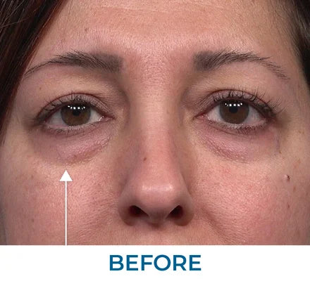 Before - Samantha G., NY