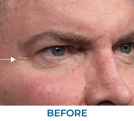 Before - Stephen K., NY