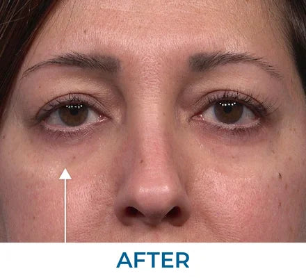 After - Samantha G., NY
