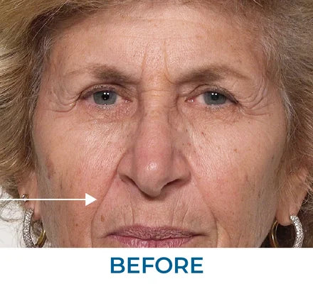 Before - Laura A., FL