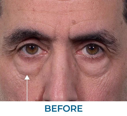Before - Ritchie G., NY