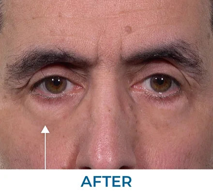 After - Ritchie G., NY